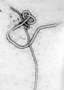 Il Virus Ebola