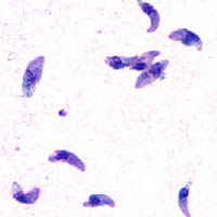 Il batterio Toxoplasma gondii  al microscopio