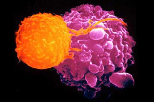 cellula_cancro_linfoma
