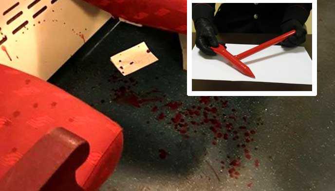 Cassano d'Adda, romeno sfonda il cranio a una ragazza 22enne per 15 euro