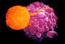 cellula cancro linfoma
